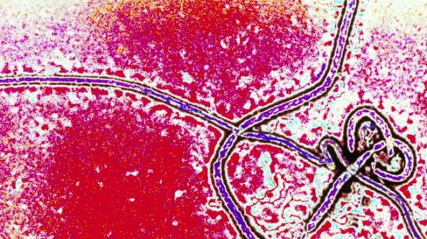 Учените разработиха ваксина срещу вируса Ебола