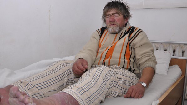 В хасковската болница приеха бездомник със сериозно измръзнали крака (снимки)
