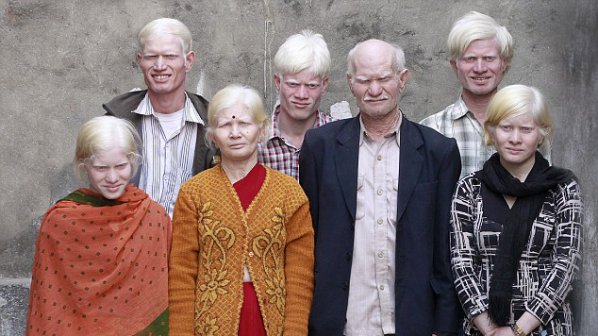Най-голямото семейство албиноси в света (снимки)