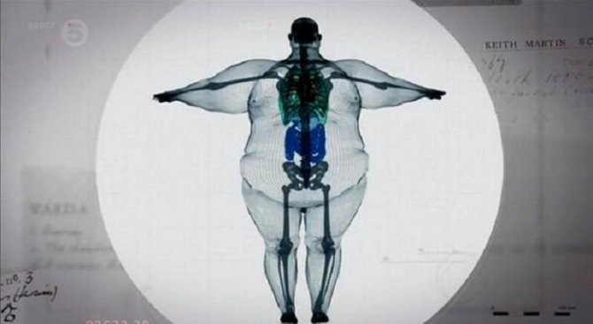 Доказателство, че наднорменото тегло не е ген