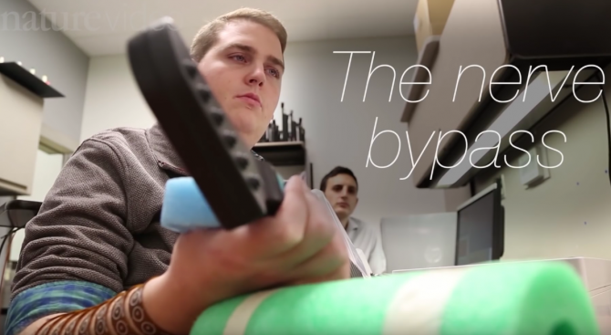 Парализиран пациент задвижи ръката си чрез мозъчен чип (видео)