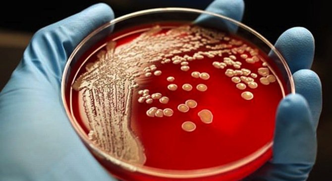 Вече има супербактерия, която не се лекува с нито един антибиотик