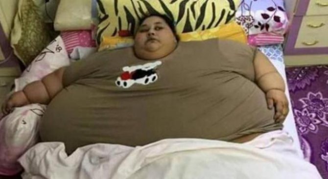 Най-дебелата жена в света ще бъде оперирана в Индия