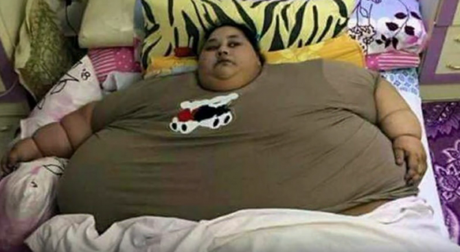 Най-дебелата жена в света отслабнала със 140 кг след операция и диета в Индия