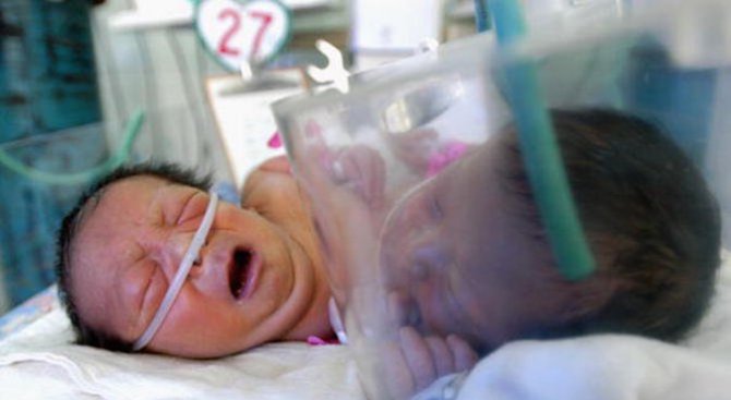 Фондът за лечение на деца отказа операция за разделяне на сиамските близнаци от Сливен
