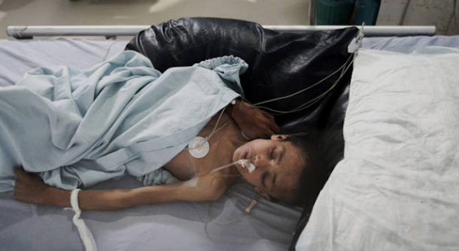 УНИЦЕФ предупреждава за опасност от нова епидемия от холера в Йемен