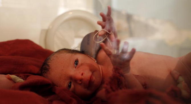 Преждевременно родените бебета в Македония ще бъдат спасявани от български експерти 
