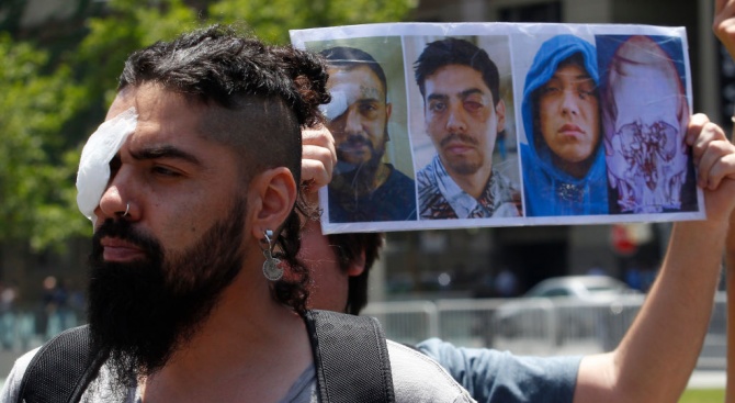 Чилийци, изгубили очите си по време на протестите, се събраха на демонстрация в Сантяго