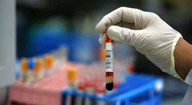 Безплатни и анонимни тестове за СПИН в Русе 