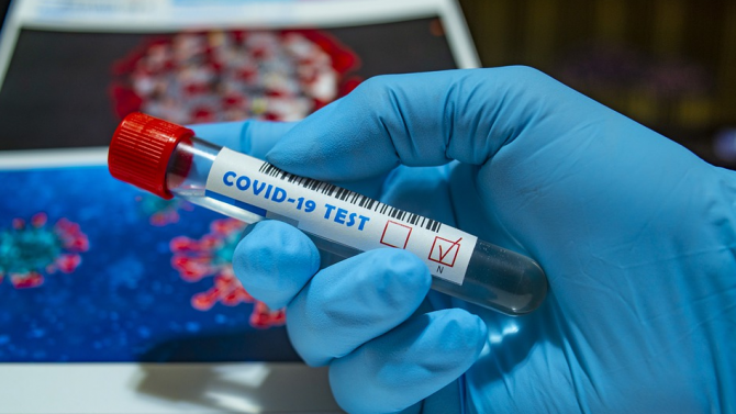 Починалите от коронавируса в Колумбия вече са над 1000