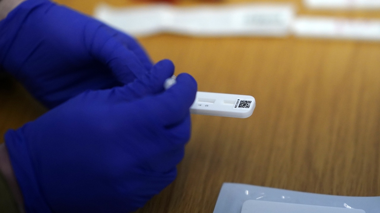 Чехия регистрира близо 10 000 нови случая на коронавирус
