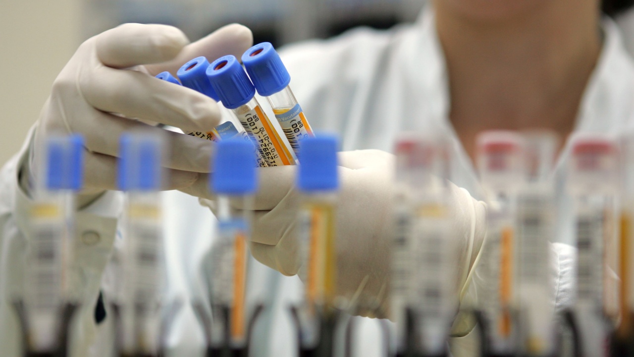 300 души на ден се тестват за антитела в Монтана