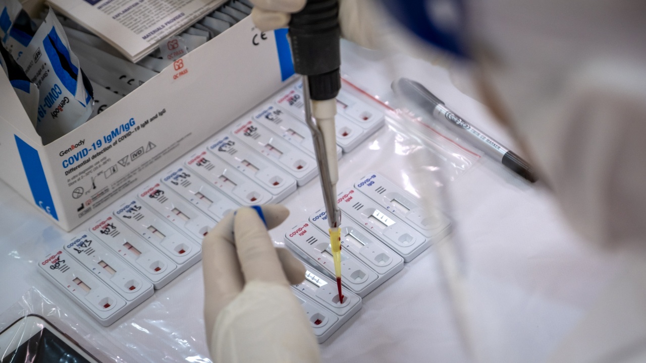 Румъния получи първите неинвазивни тестове срещу COVID-19 за училищата