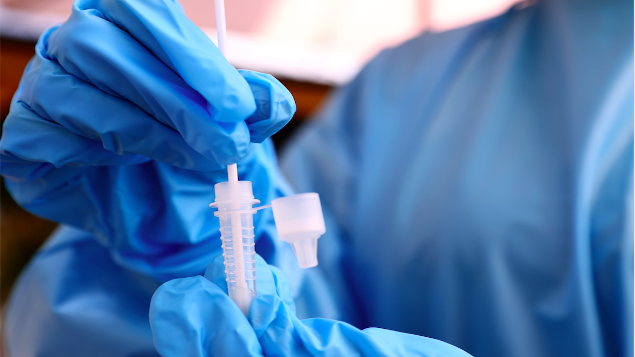 Тестовете най-точно определят дали сме се заразили с COVID-19, грип или настинка