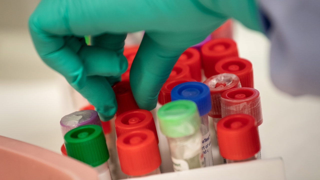 Германия регистрира 81 417 нови случая на заразяване с коронавирус