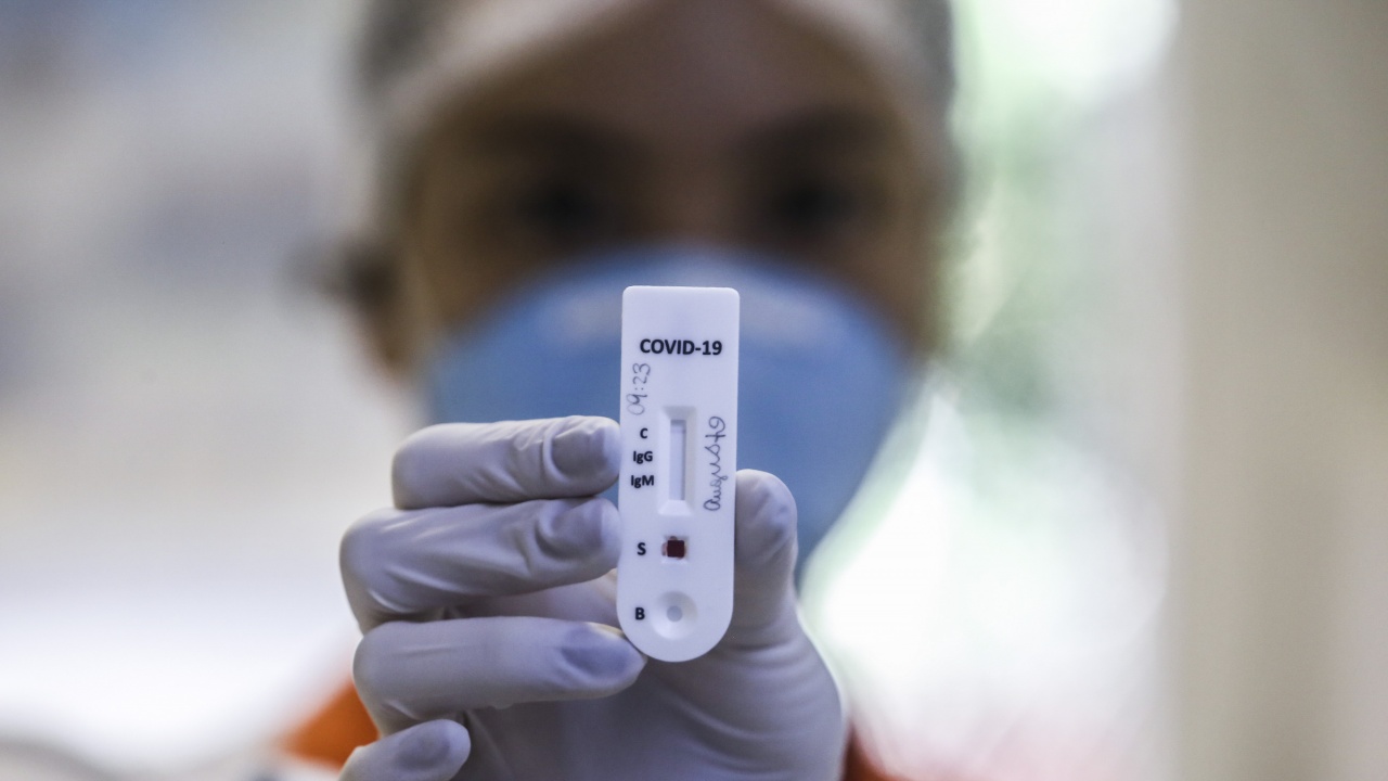 Бразилия регистрира 135 080 нови случая на заразяване с коронавирус