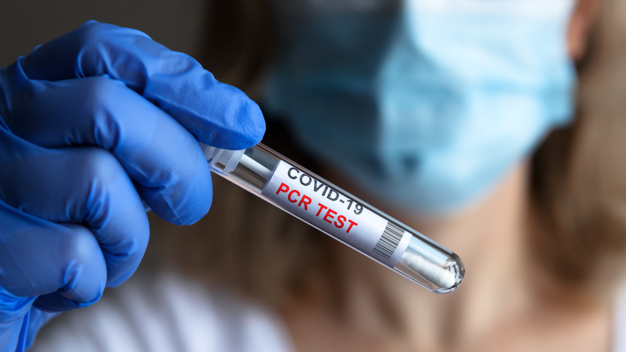 COVID болни чакат по 2 седмици направление за PCR
