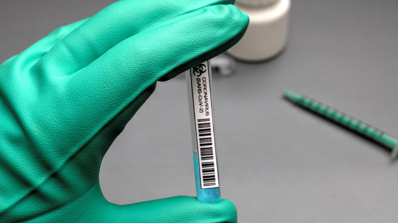 Деветдесет и два нови случая на коронавирус са били регистрирани
