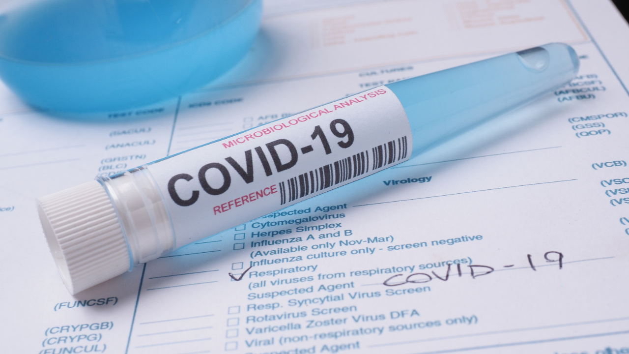 256 нови случая на заразяване с коронавирус