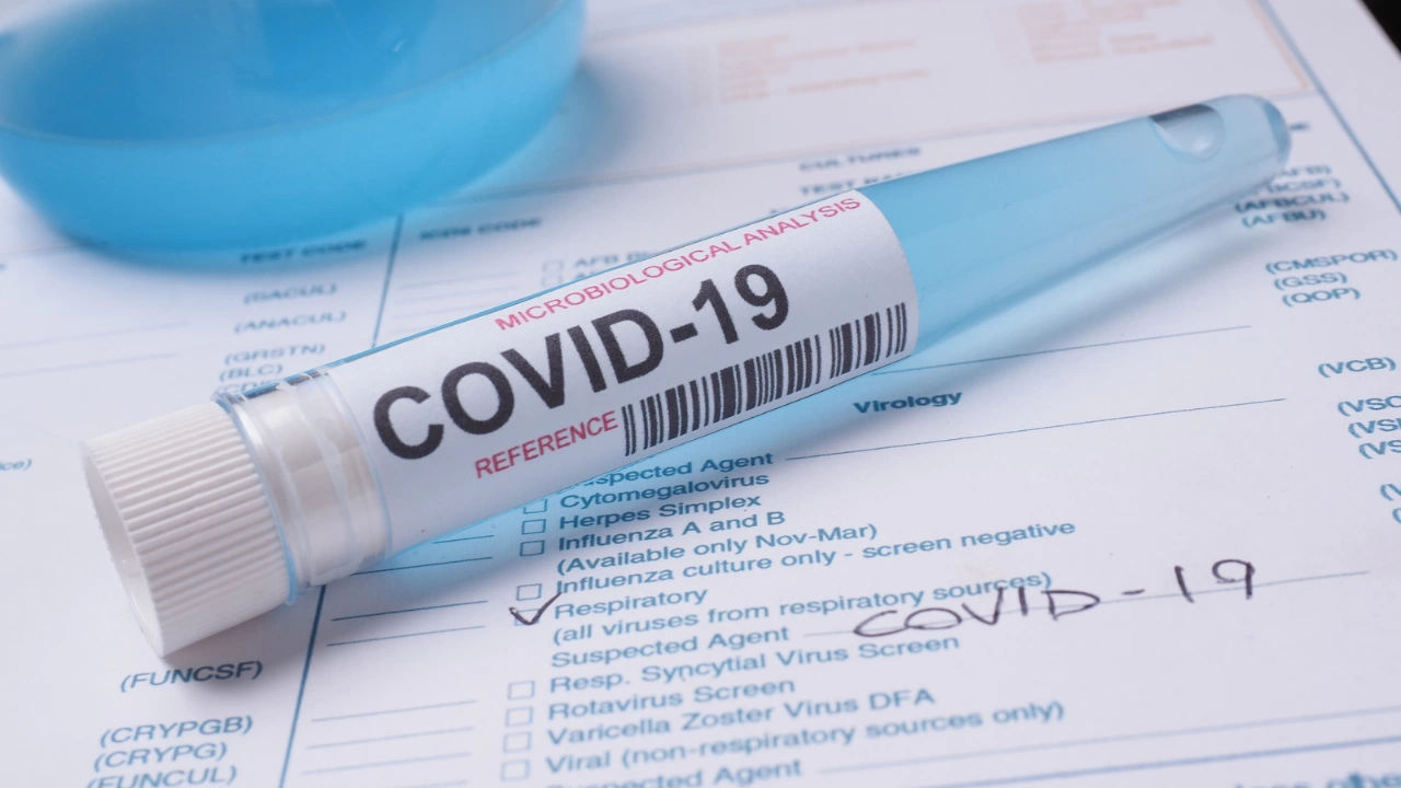 Новите случаи на КОВИД-19 за последното денонощие cа 1021.
Всичко по
