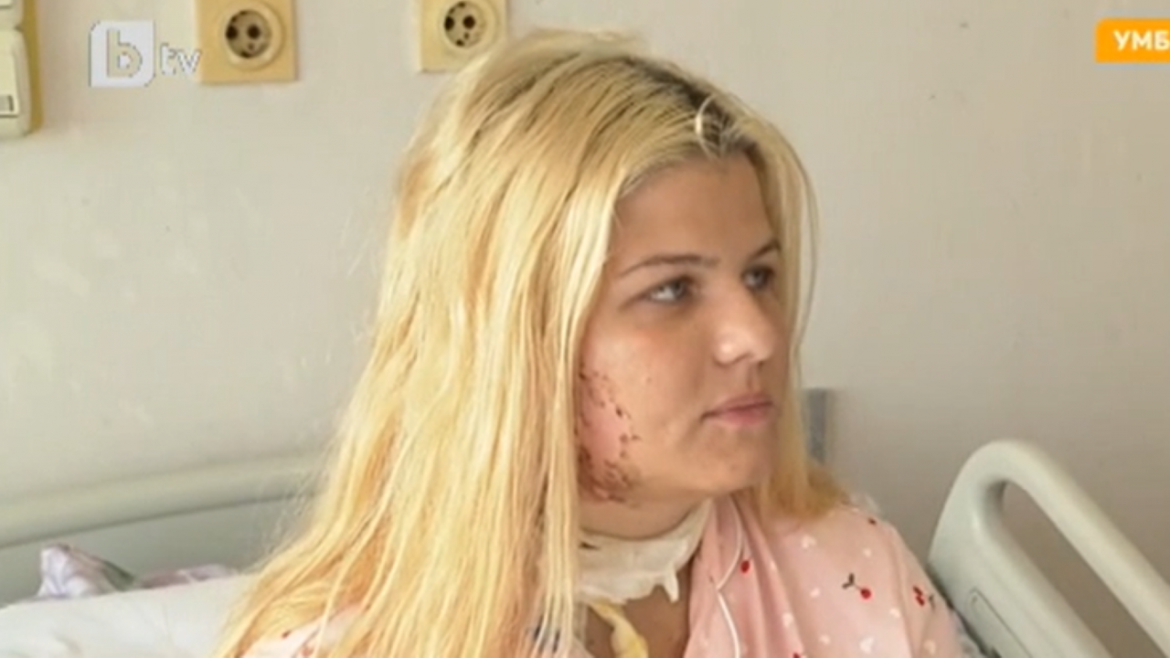 18-годишната Теодора, ударена от мълния в Приморско: Втори живот живея