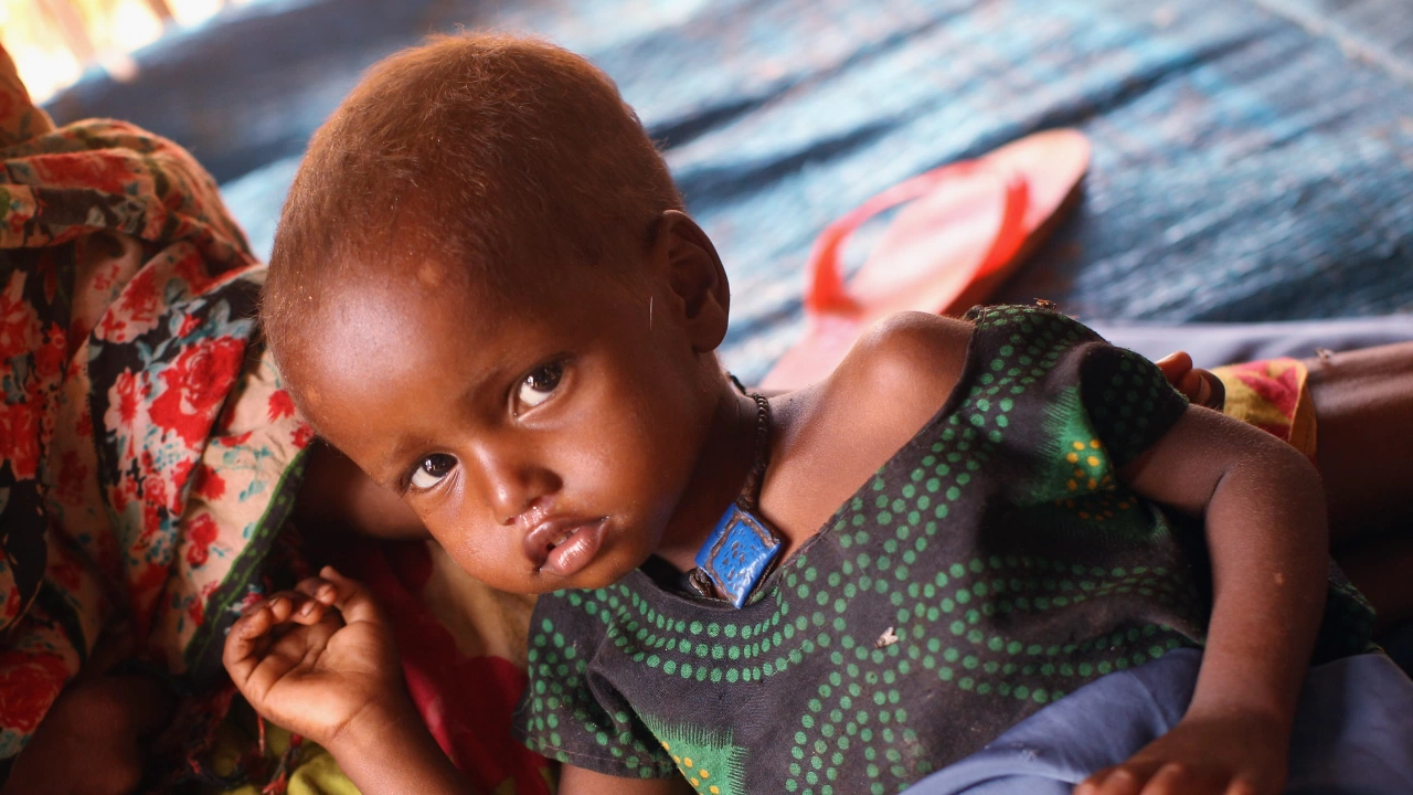 Четиригодишно дете от Кения оцеля в условия в които и