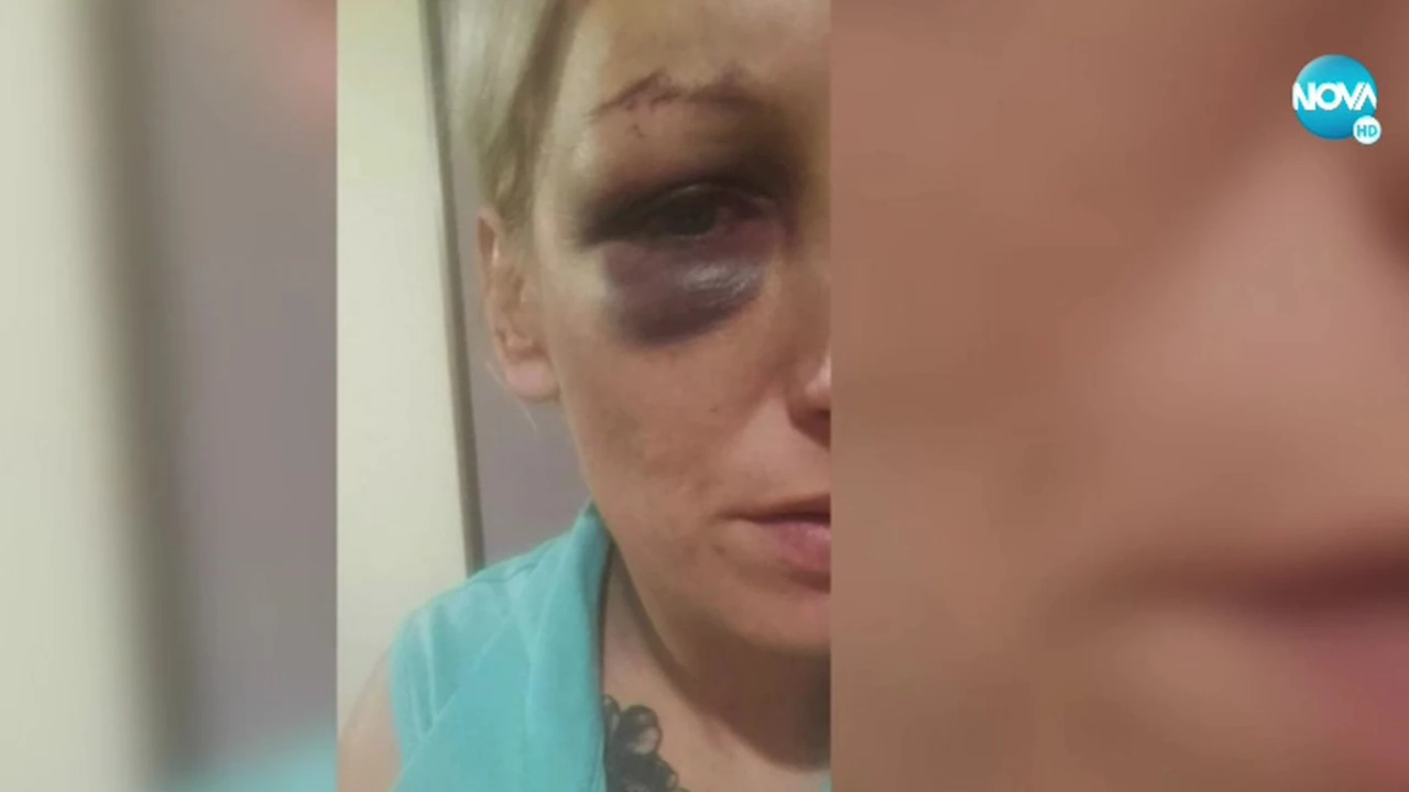 Млада жена твърди че е бита и държана в плен