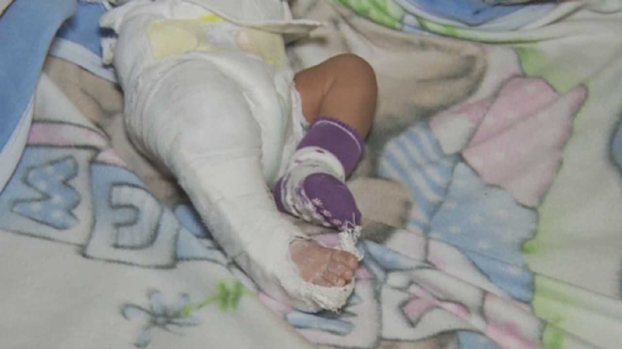 Недоволство заради бебе, прието в болницата в Благоевград с хепатит