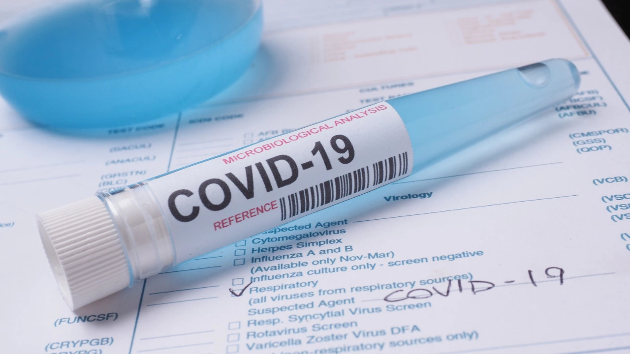 28 са новите случаи на зараза с Ковид 19 в България