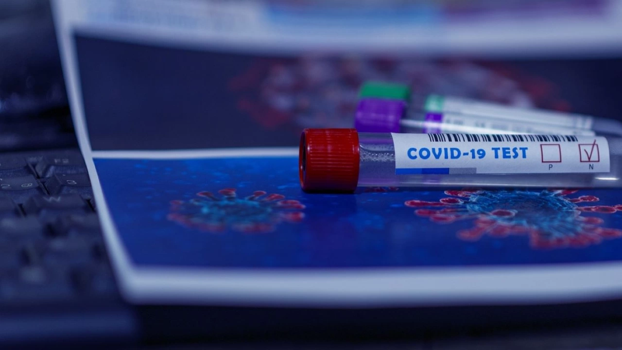 31 са новите случая на коронавирус през последното денонощие в