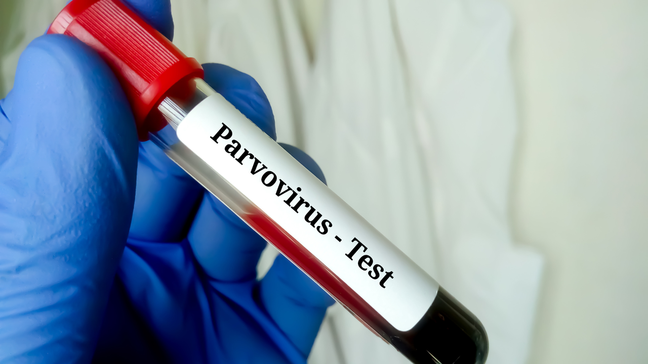 Дете почина от парвовирус - какви са симптомите?